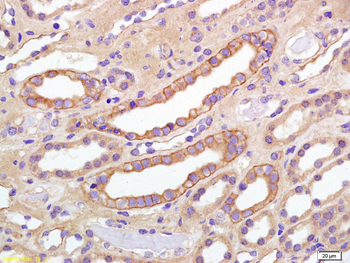 Phospho-IGF1R (Tyr980) Rabbit Polyclonal Antibody
