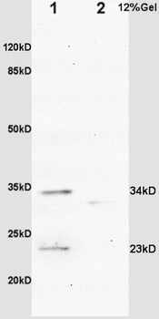 IGFBP6 Rabbit Polyclonal Antibody