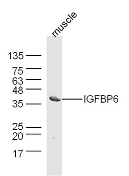 IGFBP6 Rabbit Polyclonal Antibody