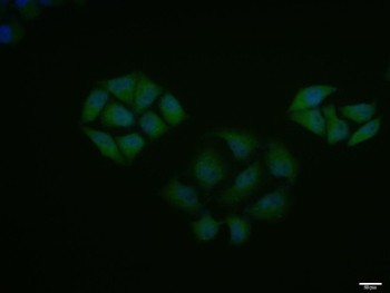 Phospho-IKK alpha (Tyr463) Rabbit Polyclonal Antibody