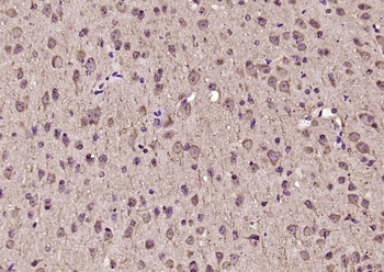 Phospho-IKK alpha/beta (Ser176 + Ser180) Rabbit Polyclonal Antibody