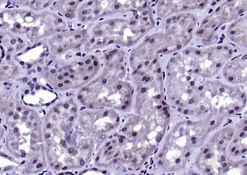 Phospho-IKK beta (Tyr188) Rabbit Polyclonal Antibody