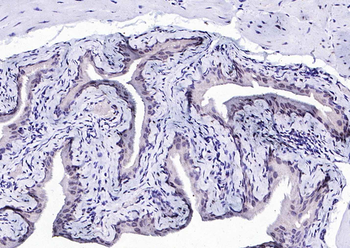 Phospho-IKK beta (Tyr188) Rabbit Polyclonal Antibody
