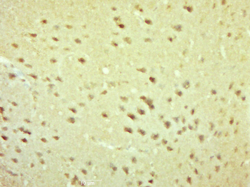 Phospho-IKK beta (Ser466) Rabbit Polyclonal Antibody