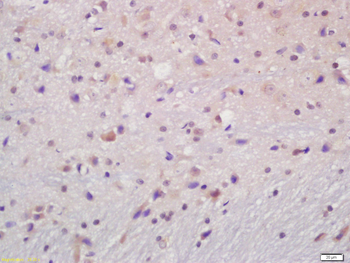 Phospho-IKK beta (Ser466) Rabbit Polyclonal Antibody