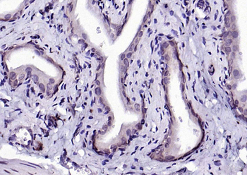 Phospho-IKK beta (Tyr199) Rabbit Polyclonal Antibody