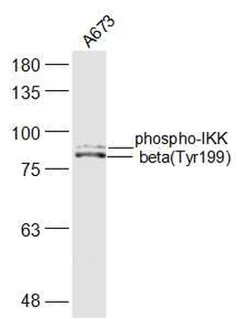 Phospho-IKK beta (Tyr199) Rabbit Polyclonal Antibody