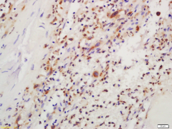 Phospho-IKK beta (Tyr199) Rabbit Polyclonal Antibody