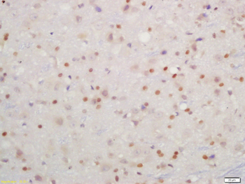 Phospho-IKK beta (Tyr199) Rabbit Polyclonal Antibody