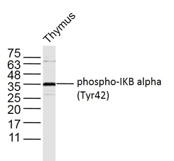 NFKBIA (phospho-Tyr42) antibody