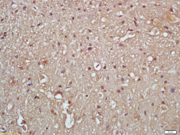 Phospho-IKK gamma (Ser376) Rabbit Polyclonal Antibody