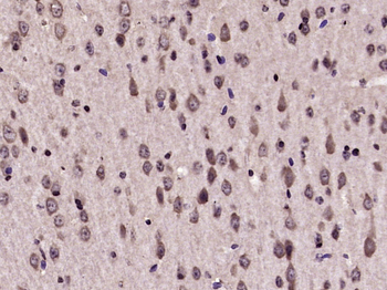 IL17D Rabbit Polyclonal Antibody