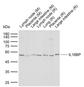 IL18BP Rabbit Polyclonal Antibody