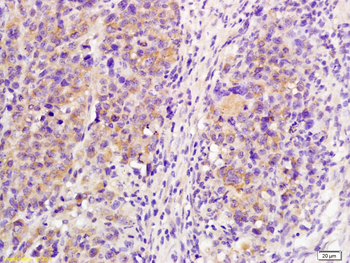 IL21R Rabbit Polyclonal Antibody