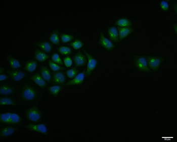LRP5 Rabbit Polyclonal Antibody