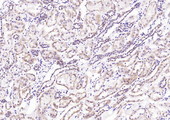 LRP5 Rabbit Polyclonal Antibody