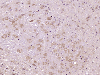 LRP5 Rabbit Polyclonal Antibody