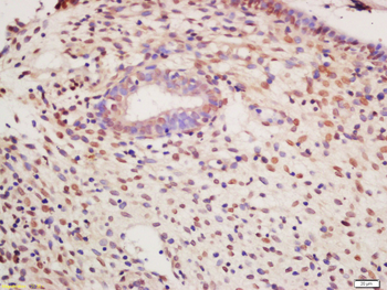 Phospho-PKM2 (Tyr105) Rabbit Polyclonal Antibody