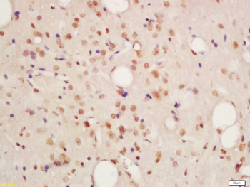 Phospho-PKM2 (Tyr105) Rabbit Polyclonal Antibody