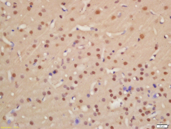 Phospho-PKM2 (Tyr105) Rabbit Polyclonal Antibody