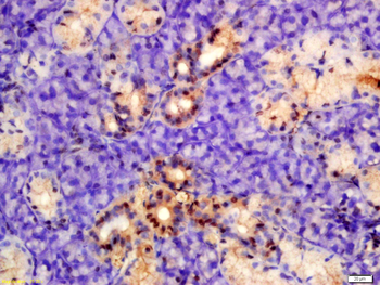 Phospho-PKM2 (Tyr105) Rabbit Polyclonal Antibody
