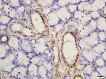 Phospho-PKM2 (Tyr105) Rabbit Polyclonal Antibody