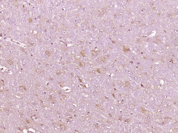 Phospho-MARCKS (Ser152 + Ser156) Rabbit Polyclonal Antibody
