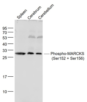 Phospho-MARCKS (Ser152 + Ser156) Rabbit Polyclonal Antibody