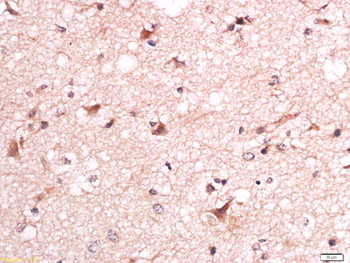 Phospho-CRTC1 (Ser151) Rabbit Polyclonal Antibody