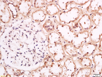 Phospho-CRTC1 (Ser151) Rabbit Polyclonal Antibody