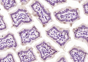 PPP1CA Rabbit Polyclonal Antibody