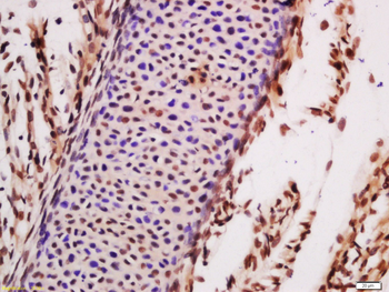 TLK1 Rabbit Polyclonal Antibody