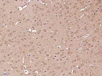 Phospho-Tuberin (Thr927) Rabbit Polyclonal Antibody