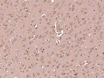 Phospho-Tuberin (Thr927) Rabbit Polyclonal Antibody