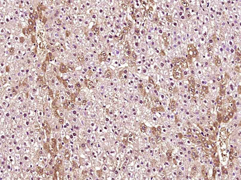 Phospho-Tuberin (Thr927) Rabbit Polyclonal Antibody