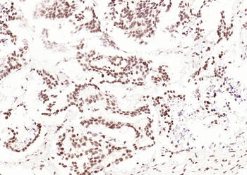 CDCA7 Rabbit Polyclonal Antibody