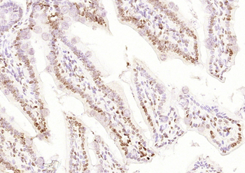 CDCA7 Rabbit Polyclonal Antibody