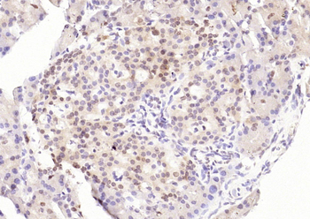 CDCA7 Rabbit Polyclonal Antibody