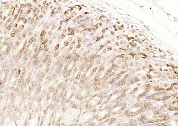 CDCA7 Rabbit Polyclonal Antibody
