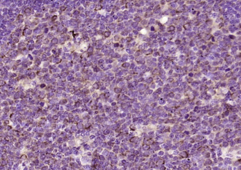 Aurora A+B+C Rabbit Polyclonal Antibody