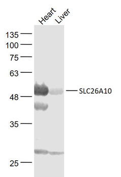 SLC26A10 Rabbit Polyclonal Antibody
