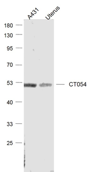 CT054 Rabbit Polyclonal Antibody