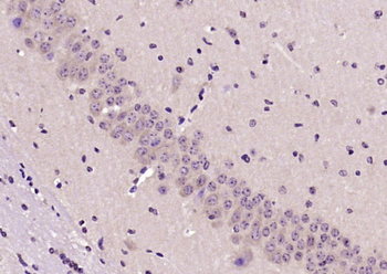 LPA1 Rabbit Polyclonal Antibody