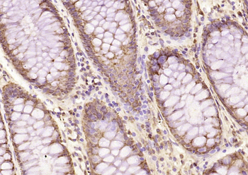 PLK4/STK18 Rabbit Polyclonal Antibody