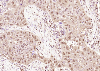 MAGEA11 Rabbit Polyclonal Antibody