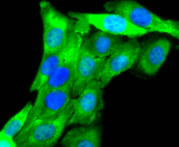 Aurora A Recombinant Rabbit Monoclonal Antibody
