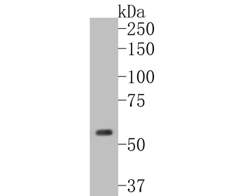 Cytokeratin 5 Recombinant Rabbit Monoclonal Antibody