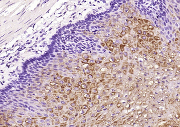 Cytokeratin 2e Recombinant Rabbit Monoclonal Antibody