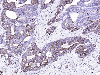 CK20 Recombinant Rabbit Monoclonal Antibody
