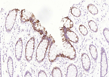 CK20 Recombinant Rabbit Monoclonal Antibody